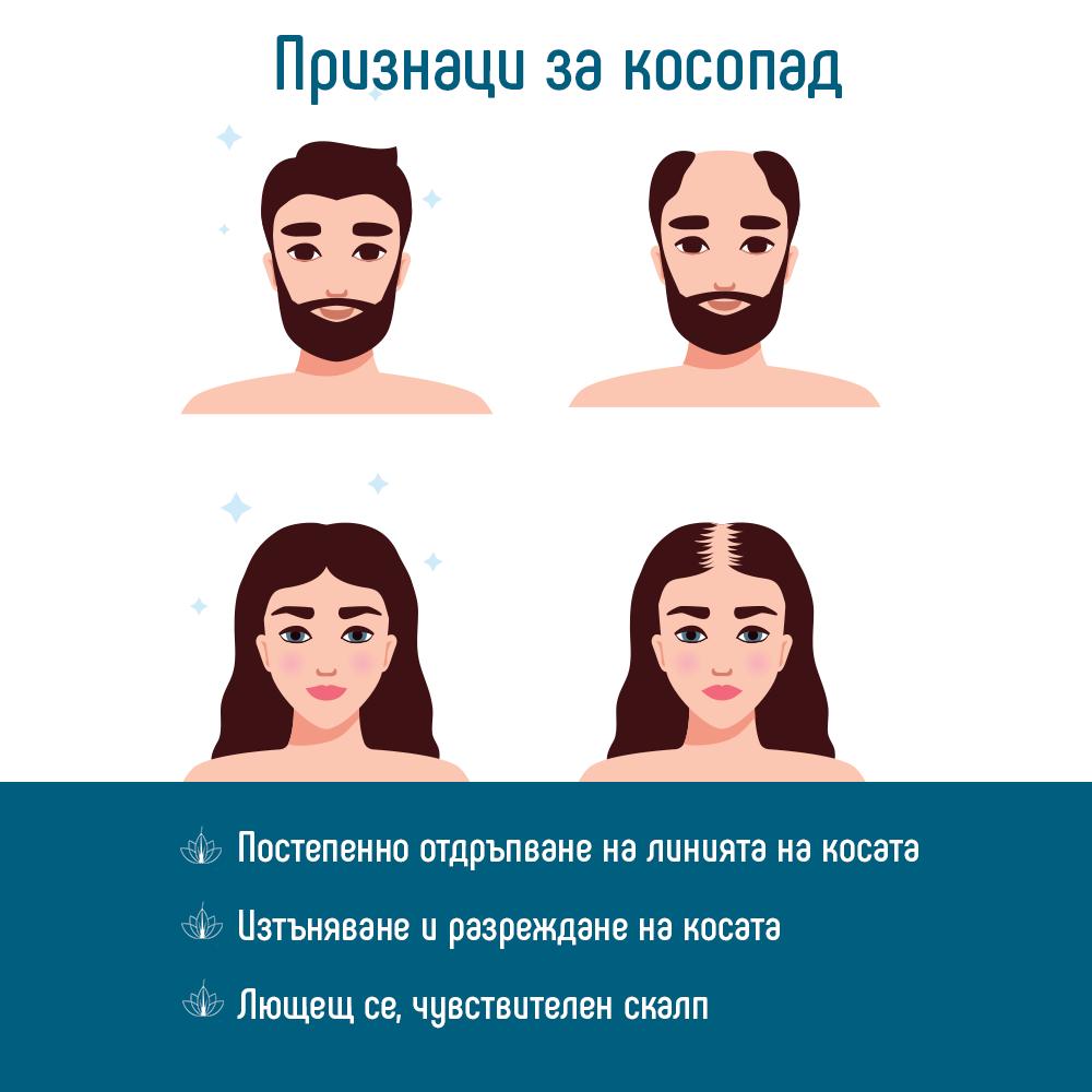 Признаци  на косопад